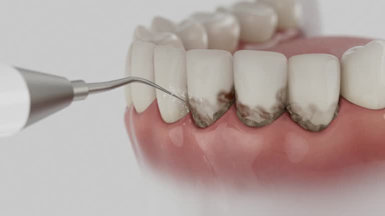 Reliable Dental Implants contractor in Oreland, PA by Smile Center Dentistry